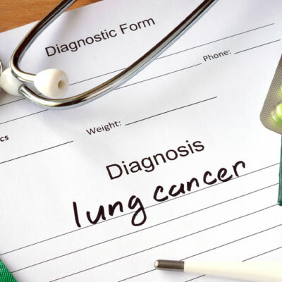 3 crucial tips for managing lung cancer