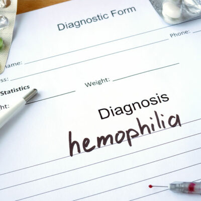 Hemophilia &#8211; Its types, symptoms, and management