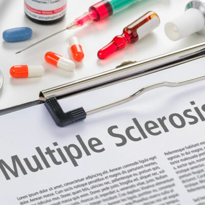 Multiple Sclerosis &#8211; Causes and Early Warning Signs