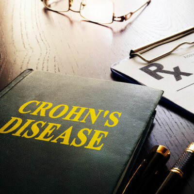 Top 10 early warning signs of Crohn&#8217;s