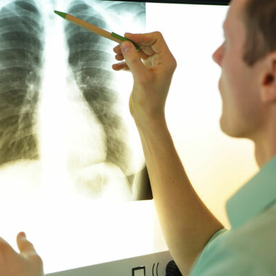 MAC lung disease &#8211; 8 common signs and management options